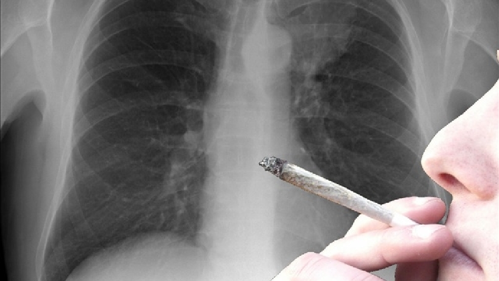 Study smoker's lung better than none KATV